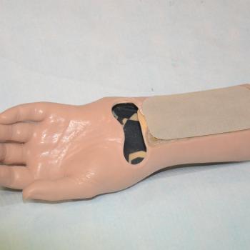 E 021 Proteza kosmetyczna w obrębie ręki