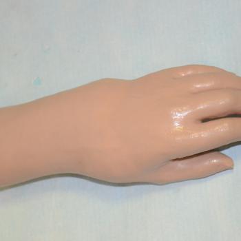 E 021 Proteza kosmetyczna w obrębie ręki