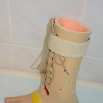 A 002 Proteza uzupełniająca stopę
