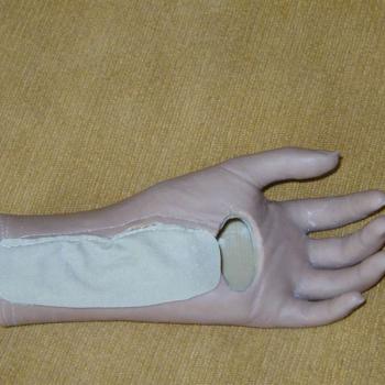 proteza uzupełnienia dłoni